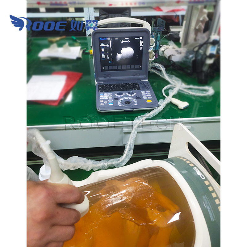 US-K2 Portable Ultrasound Scanner Color Doppler Ultrasound Diagnostic System (7).jpg