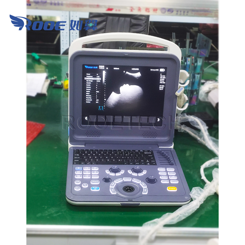 US-K2 Portable Ultrasound Scanner Color Doppler Ultrasound Diagnostic System (6).jpg
