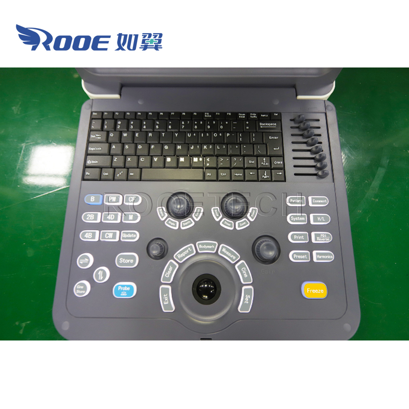 US-K2 Portable Ultrasound Scanner Color Doppler Ultrasound Diagnostic System (5).jpg
