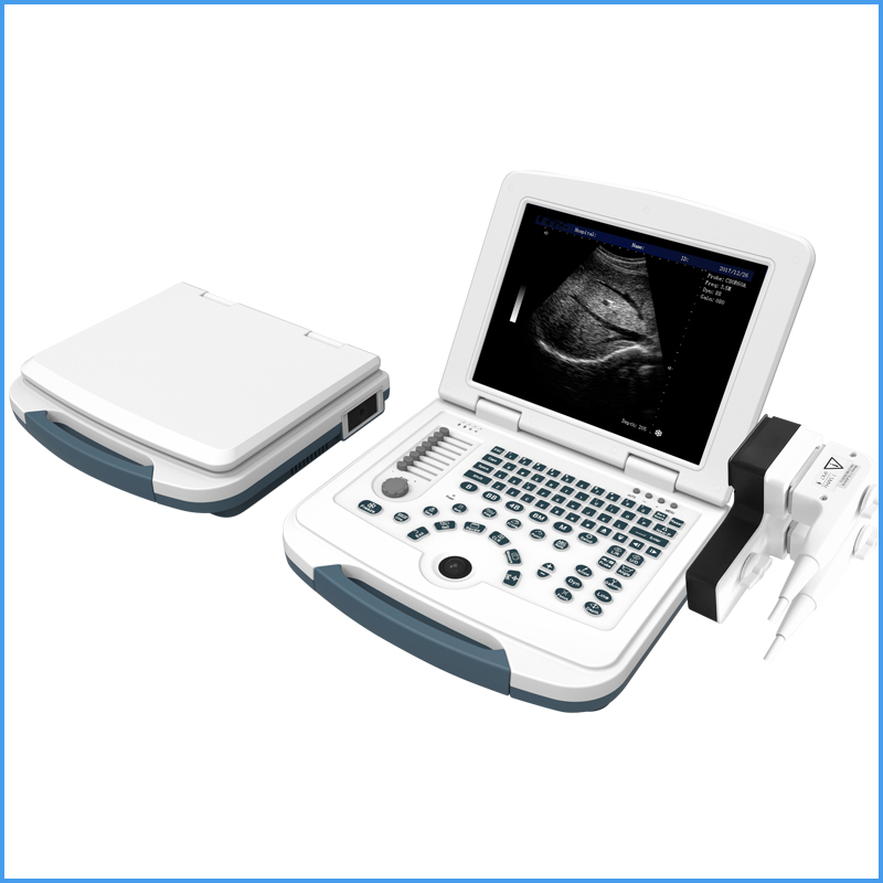 Appareil ultrasonique portatif médical d'ultrason de Doppler de la couleur US580 4D