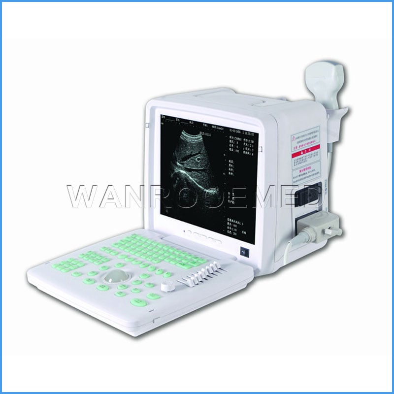 Scanner portatif d'ultrason de matériel médical US360