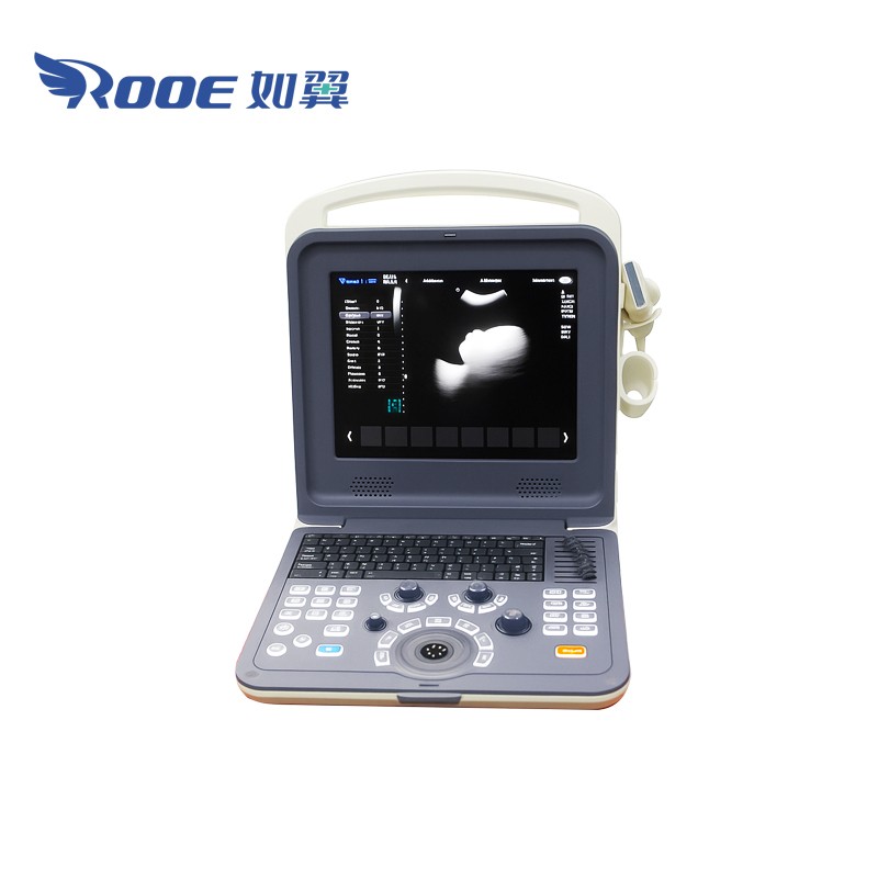 US-K2 Portable Ultrasound Imaging System with Color Doppler Diagnostic System