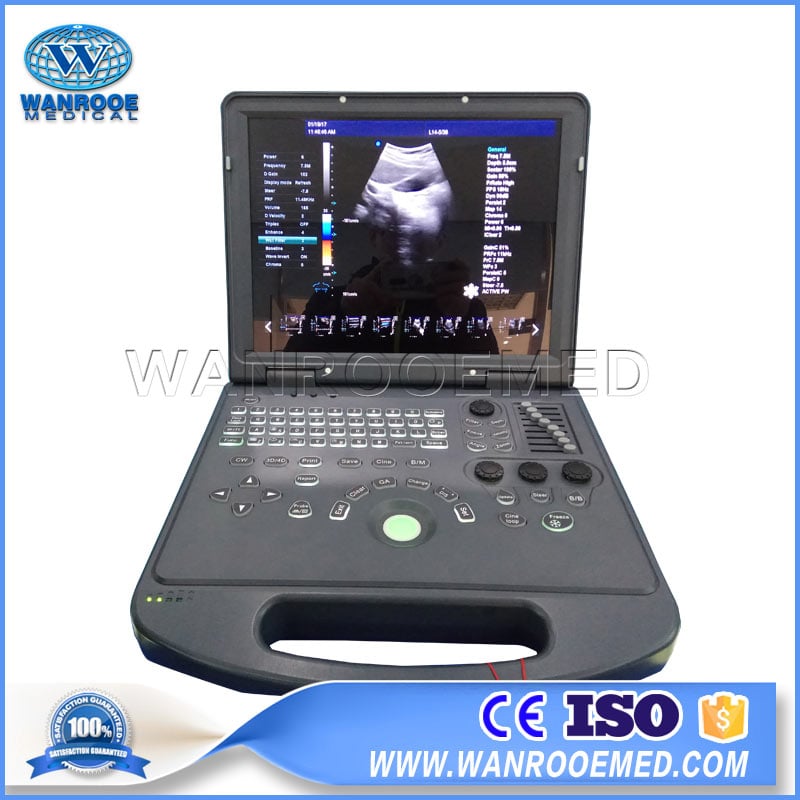 USC60 Hospital Color Doppler Portable Laptop Ultrasound Scanner 