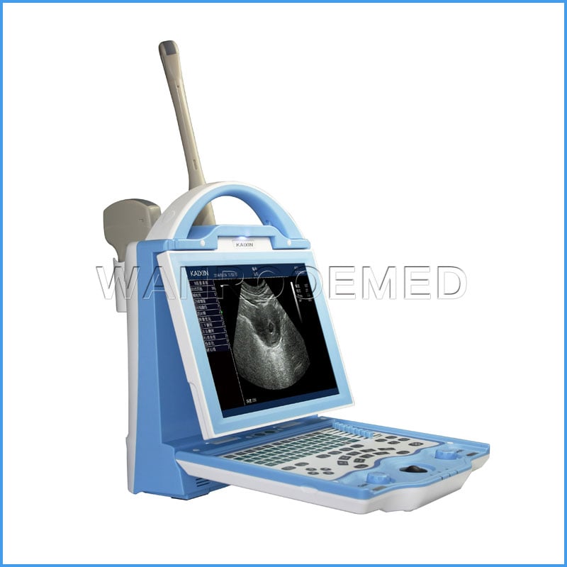 Prix ​​de machine d'ultrason portatif de Doppler de couleur médicale d'USKX5600