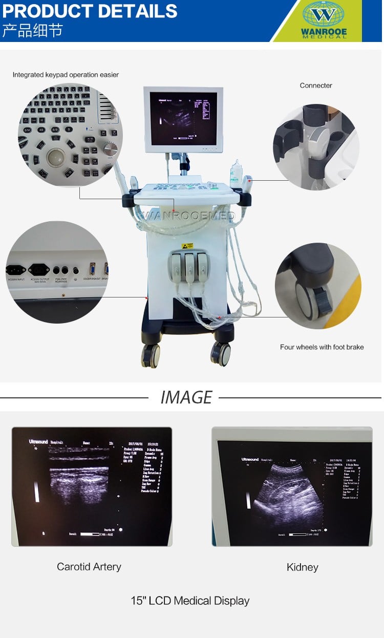 US370 Medical Full-Digital Trolley Pregnancy Fetal Diagnostic Ultrasound Scanner Machine.jpg