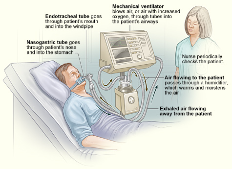 Medical Ventilator, Ventilator, Ventilator Machine Price, ICU Ventilator, Patient Ventilator