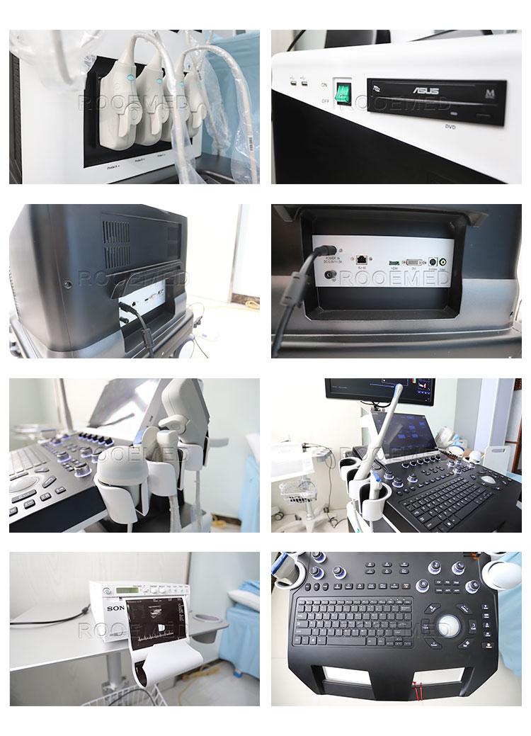 ultrasound scanner,ultrasound machine,baby ultrasounds,ob/gyn,diagnostic ultrasound