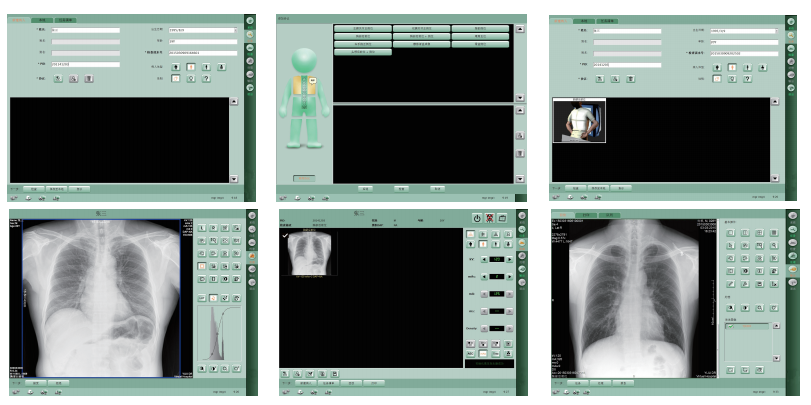 dr fluoroscopy, radiology systems, dr radiography system 