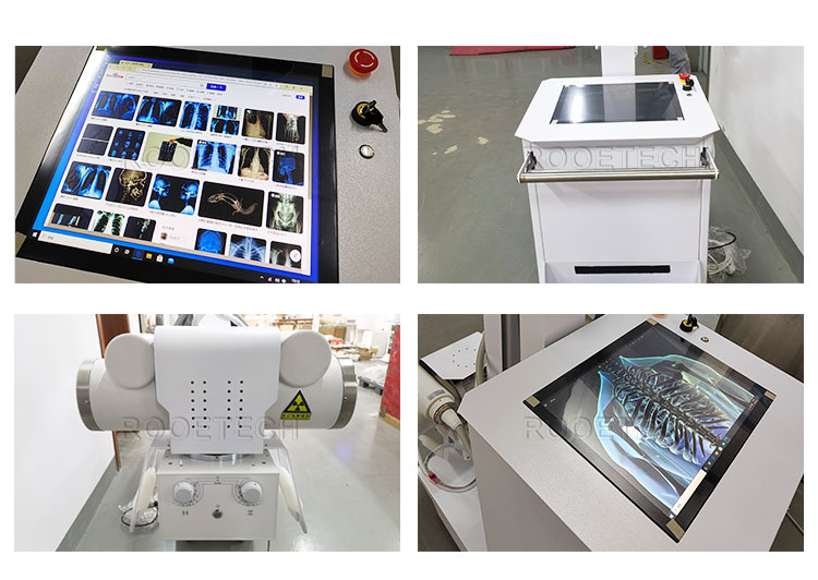analogic x ray machine,radiography machine,radiography machine,medical diagnostic equipment