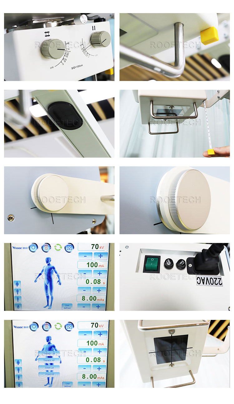 chest x ray machine, rotated chest x ray, digital radiography x ray machine