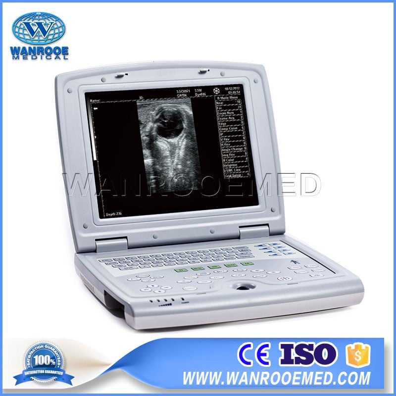 USKX5000 Laptop Vet Handheld Ultrasound Scanner For Dog And Cat Pregnancy Check