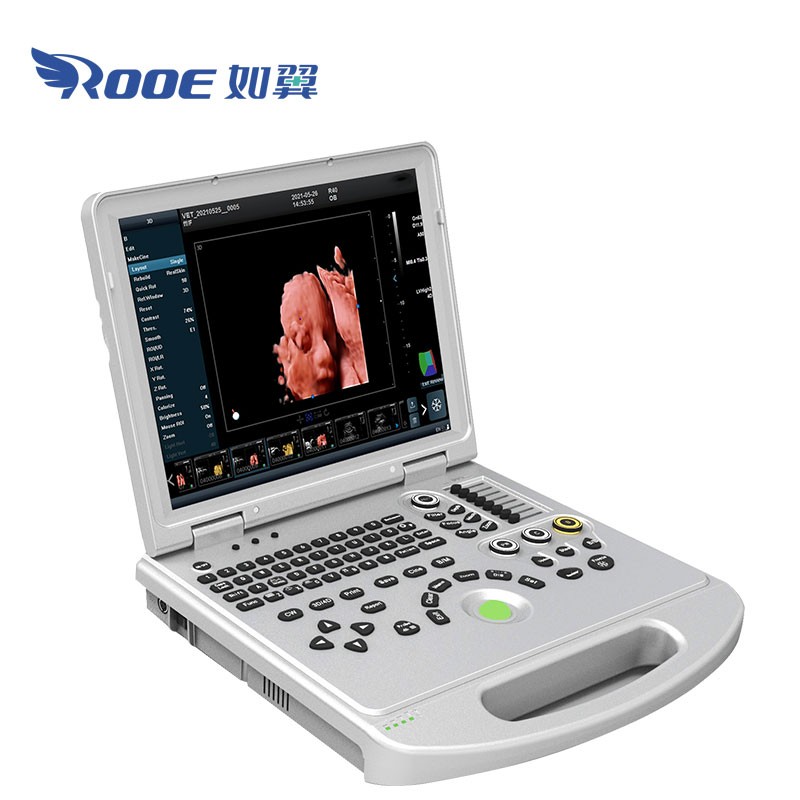 USC60plus Pro Middle-end Laptop Physics Mobile 4D Color Doppler Ultrasound System Machine