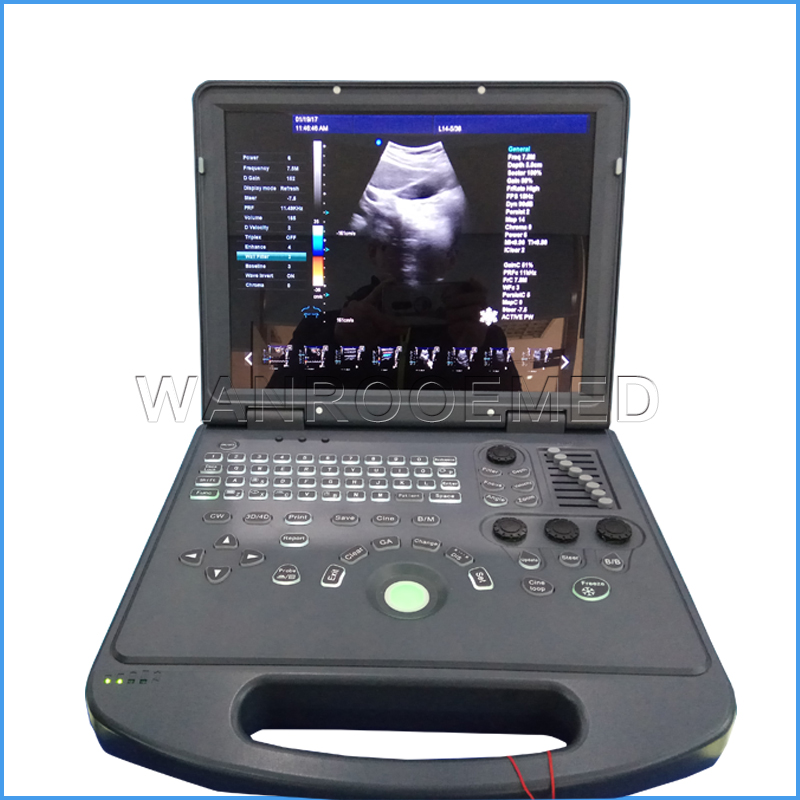 Scanner portatif d'ultrason de B d'équipement médical d'ultrason d'hôpital d'USC60
